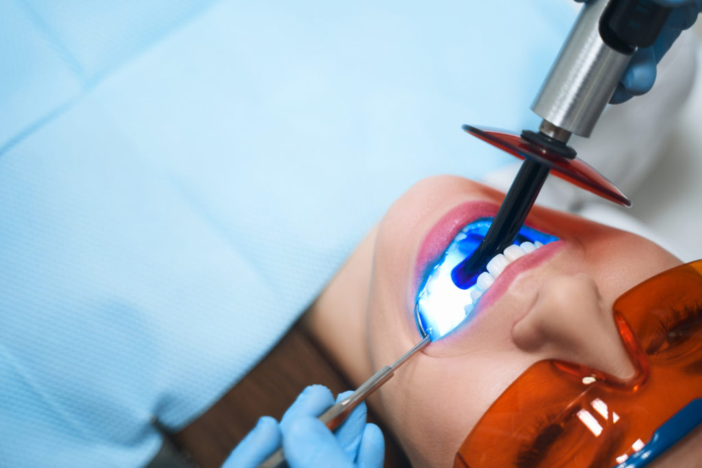 Wybielanie zębów to proces, który może przynieść wymierne korzyści estetyczne