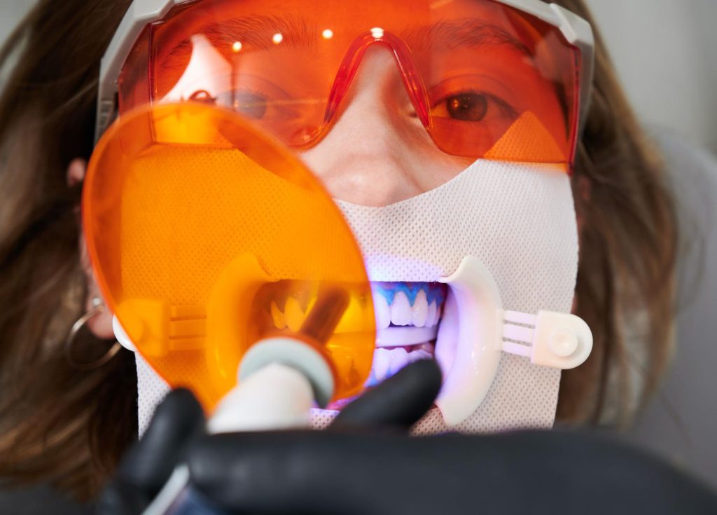 Badanie przeprowadzone na próbie pacjentów korzystających z usług poznańskich gabinetów stomatologicznych dostarcza informacji na temat najskuteczniejszych metod wybielania zębów